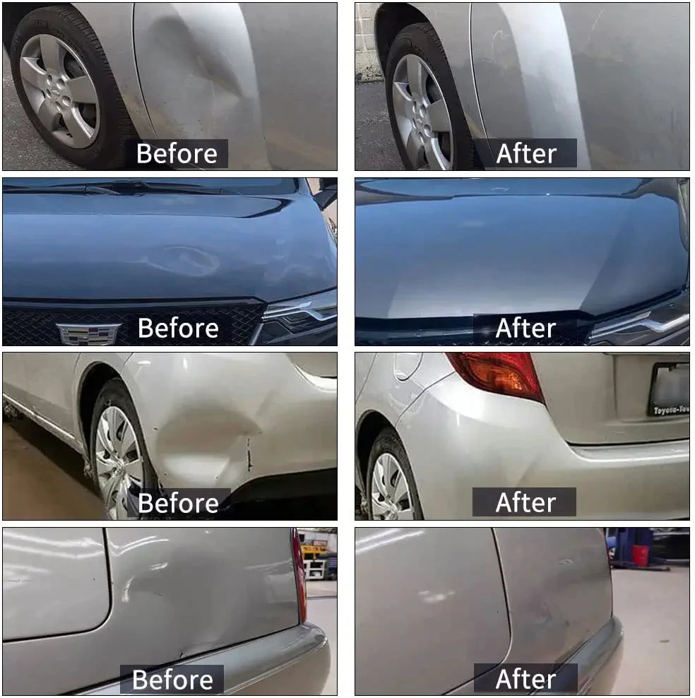 Paintless Dent Repair Tool Kit - Car Dent Remover, Slide Hammer, Glue Gun